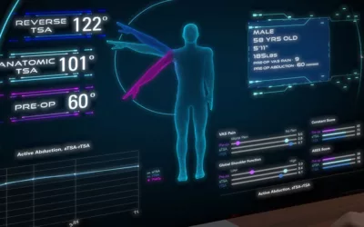 Exactech Unveils New Study on Predict+ Machine Learning Tool