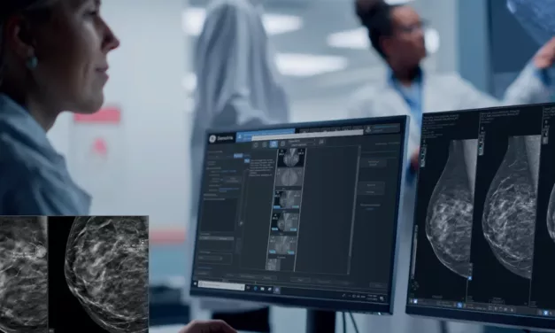 GE HealthCare Unveils MyBreastAI Suite